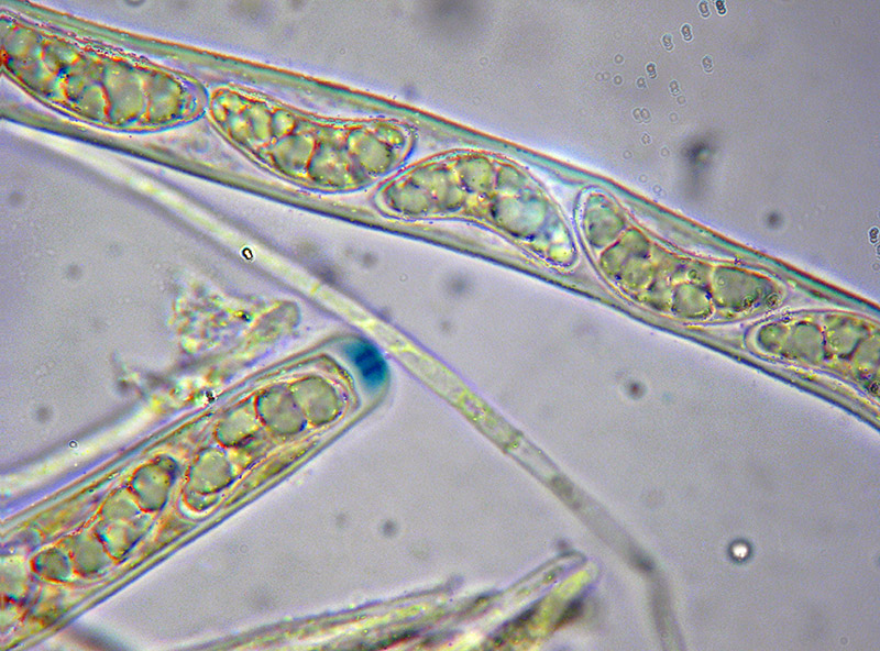 Phaeohelotium (extumescens?)